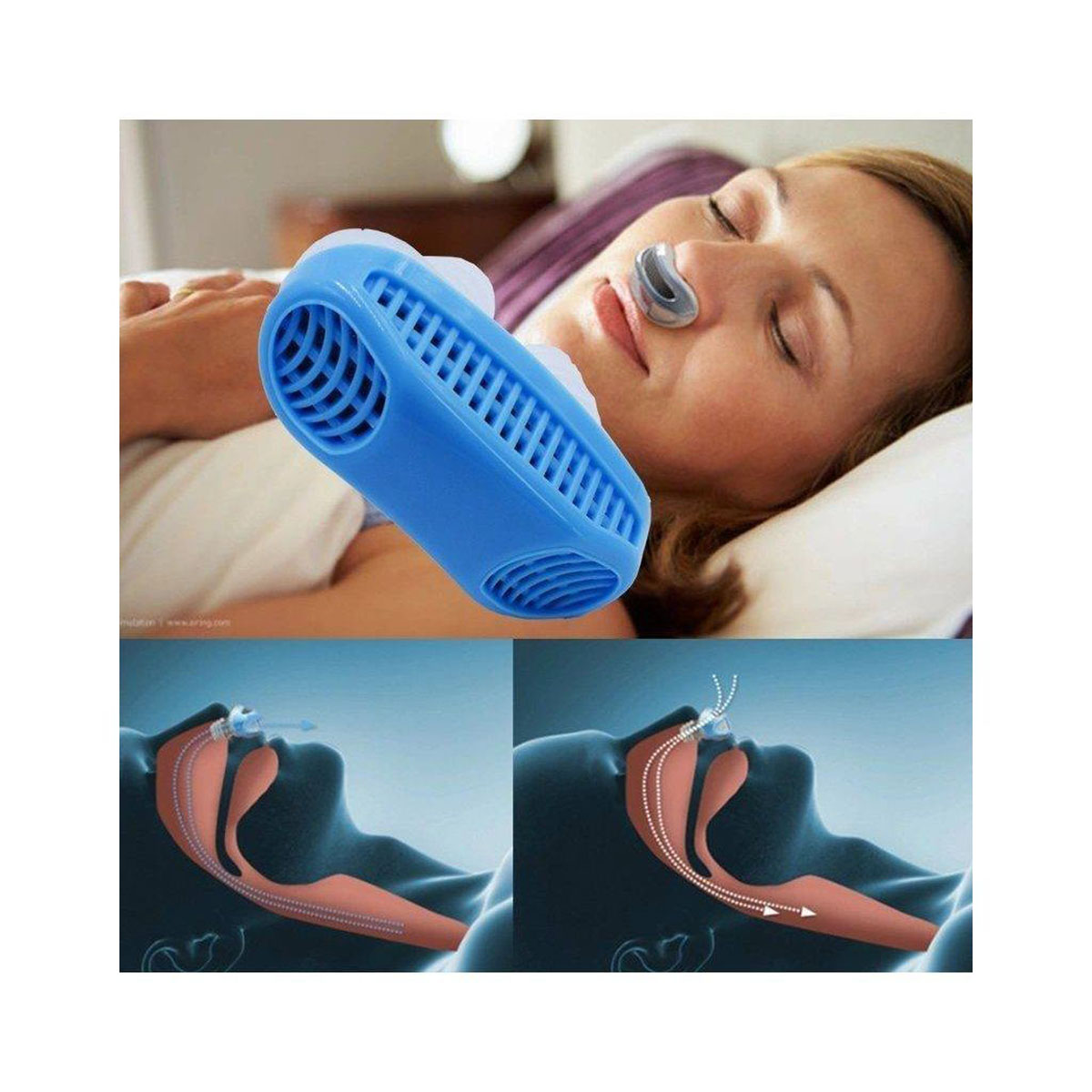 এন্টি স্নোরিং ডিভাইস